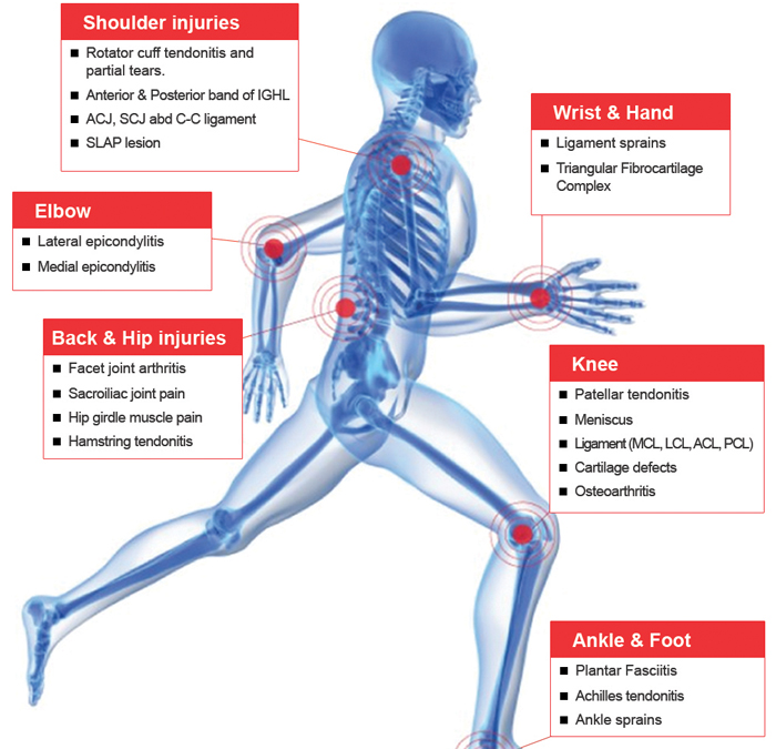 Why Get PRP Treatment?